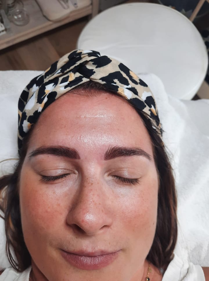 Photo d'une femme après un soin du visage.